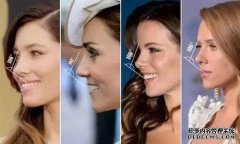 张丹凤一步一步地摔断了鼻子，他的机