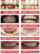 牙齿和烟草之间有什么关系？