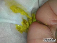 腹部三个液体腹泻屁怎么办