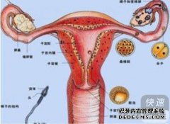 女性子宫粘连的原因是什么？