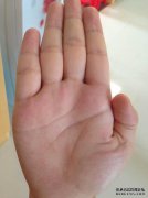 怀孕初期肚子胀怎么样？