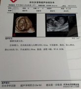 不要检查何时尽力而为