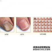 如何在脚趾上放指甲？