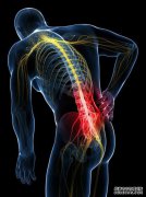 [腰间盘环的修复]