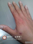 什么是钓鱼竿，用手指长出的蝎子