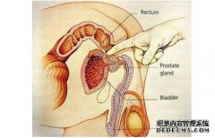 [有时，突然的肛门疼痛是什么？]