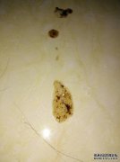 大便少的原因是什么？