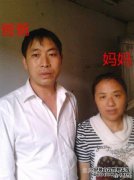 你要第二胎吗你能修复疤痕吗？