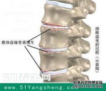 左小腿内的热量会怎样？