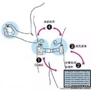 外源性胰岛素注射会降低胰腺功能吗？