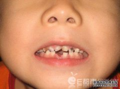 如果我的孩子不磨牙该怎么办？