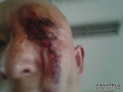 如果战斗是由轻伤引起的，该如何治疗