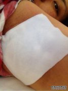 <strong>[？什么是腋下硬块？]</strong>